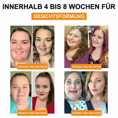 SKinXT Bienengift Dlirainage Schlankheits-Pflaster (10 Stück) 🐝