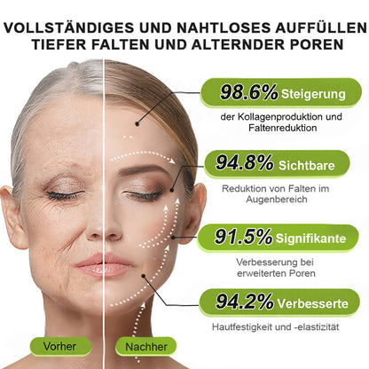Sommer-Sale nur heute! 💫👨‍⚕️SkinXT Vita-A Retinol Shot Falten-Lift Straffungscreme