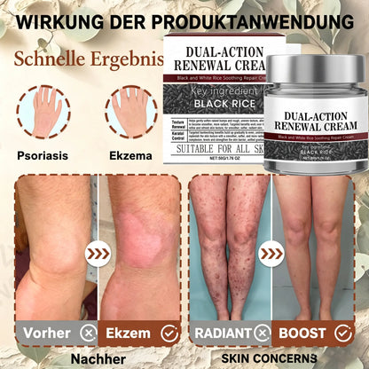 SkinXT  Doppelwirkende Erneuerungscreme