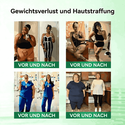 SkinXT | Nano-Nadelgerät zur Extraktion von braunem Fett (nur einmal täglich, sichtbare Ergebnisse in 7 Tagen)