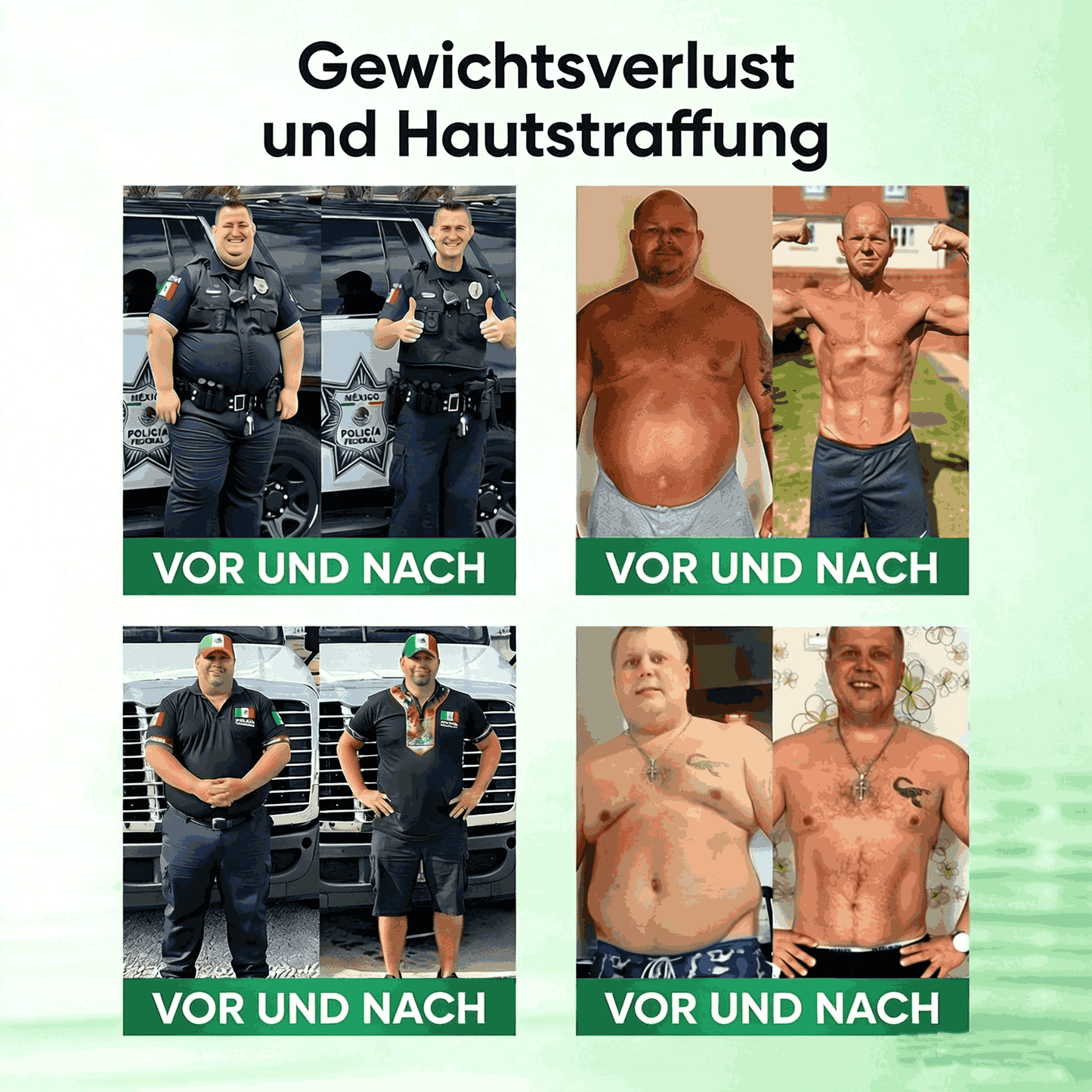 SkinXT | Nano-Nadelgerät zur Extraktion von braunem Fett (nur einmal täglich, sichtbare Ergebnisse in 7 Tagen)