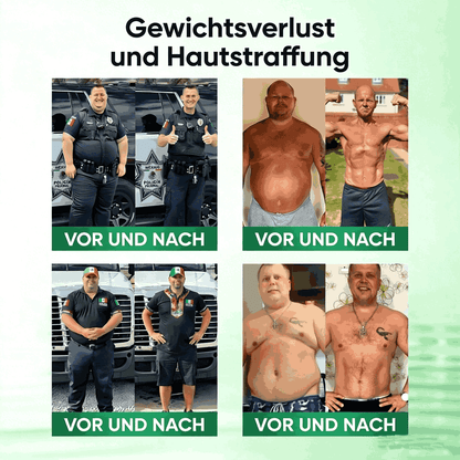 SkinXT | Nano-Nadelgerät zur Extraktion von braunem Fett (nur einmal täglich, sichtbare Ergebnisse in 7 Tagen)