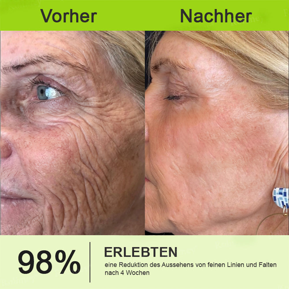 Sommer-Sale nur heute! 💫👨‍⚕️SkinXT Vita-A Retinol Shot Falten-Lift Straffungscreme