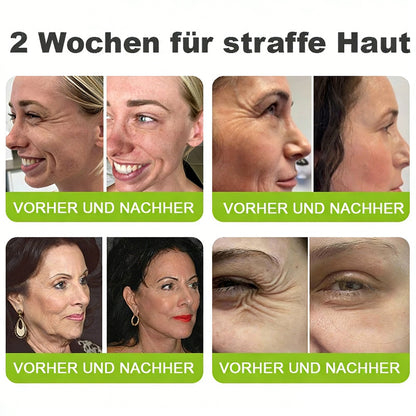 Sommer-Sale nur heute! 💫👨‍⚕️SkinXT Vita-A Retinol Shot Falten-Lift Straffungscreme