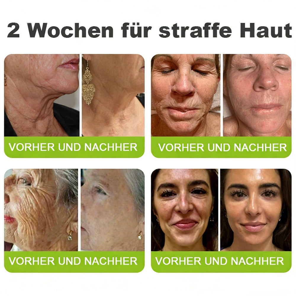 Sommer-Sale nur heute! 💫👨‍⚕️SkinXT Vita-A Retinol Shot Falten-Lift Straffungscreme