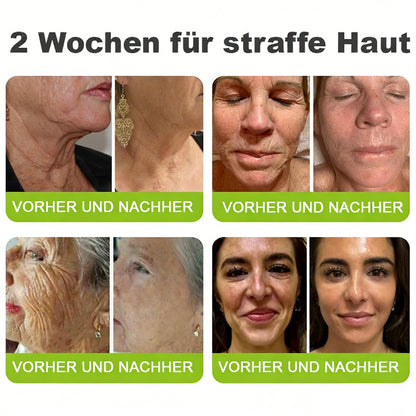 Sommer-Sale nur heute! 💫👨‍⚕️SkinXT Vita-A Retinol Shot Falten-Lift Straffungscreme