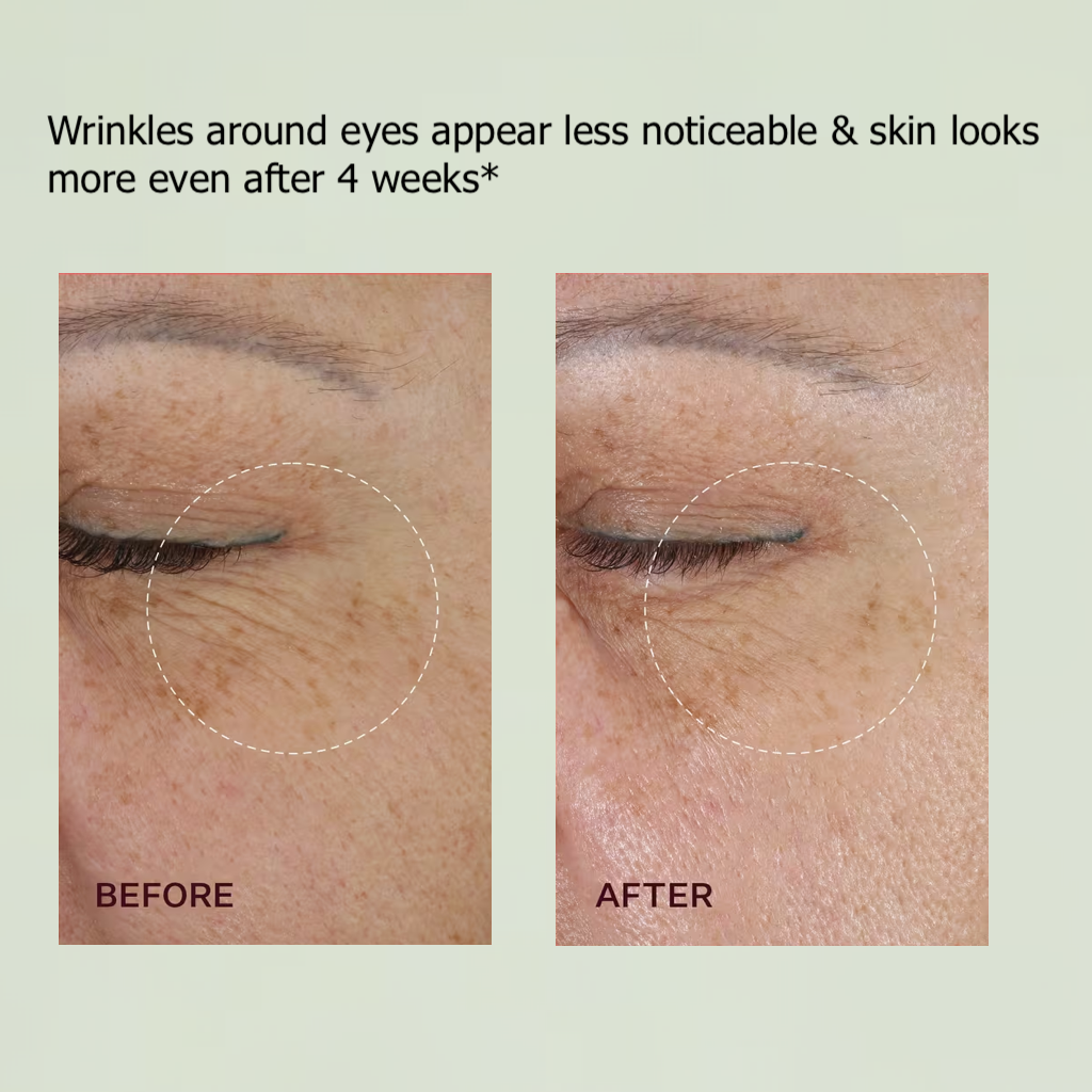 Jetzt jugendliche Haut zurückgewinnen 💫👨‍⚕️SkinXT Vita-A Retinol Shot Falten-Lift Straffungscreme